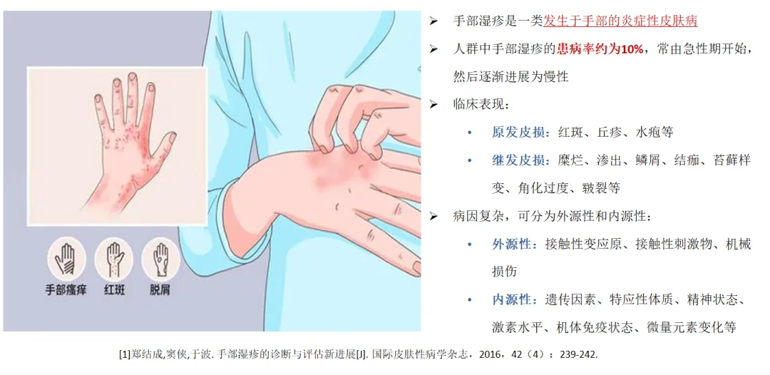 有关日本已上市药物迪高替尼在国内启动手部湿疹的三期临床研究@张建中教授 I 北京大学人民医院及全国38家参研医院