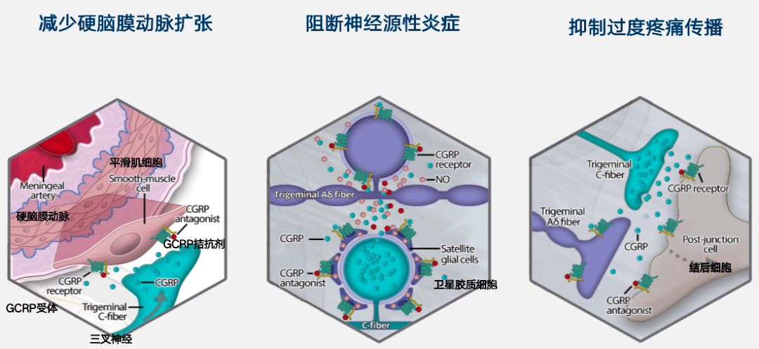 辉瑞「瑞美吉泮」国内又启动一项III期偏头痛临床研究@中国人民解放军总医院及全国55家参研医院