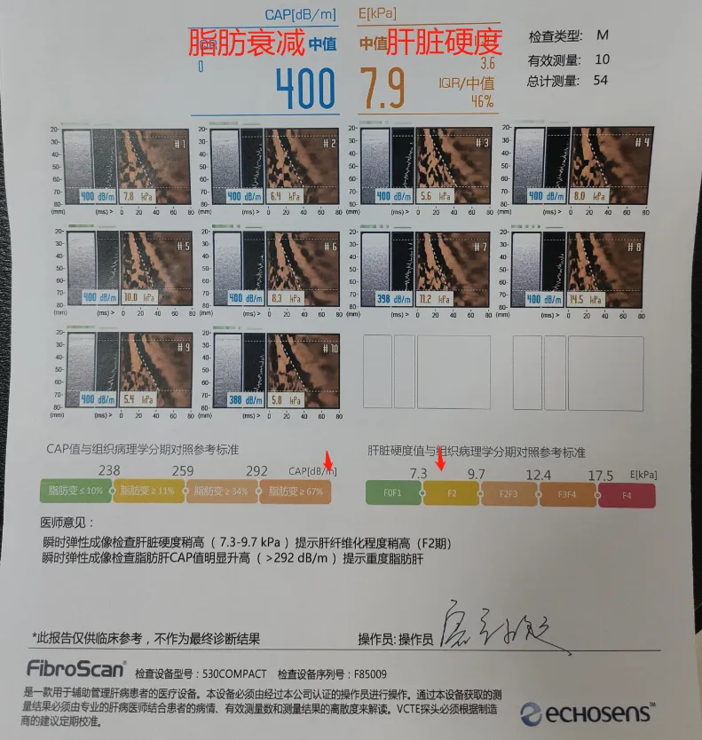 天然中成药岩黄连总碱治疗脂肪肝临床研究 I 招募脂肪肝患者@首都医科大学附属北京佑安医院及全国10家参研医院